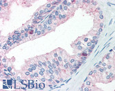 Anti-FOLH1 / PSMA Antibody (C-Terminus) IHC-plus LS-B2542