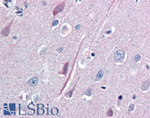 Anti-NTRK2 / TRKB Antibody (aa1-429) IHC-plus LS-B2544