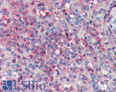 Anti-NCF1 / p47phox / p47 phox Antibody (N-Terminus) IHC-plus LS-B2549
