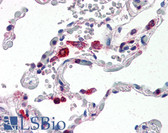 Anti-CTSS / Cathepsin S Antibody IHC-plus LS-B2550