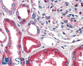 Anti-CAT / Catalase Antibody IHC-plus LS-B2554