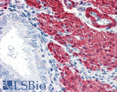 Anti-TAGLN / Transgelin / SM22 Antibody (C-Terminus) IHC-plus LS-B2563