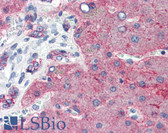 Anti-CLDN1 / Claudin 1 Antibody (C-Terminus) IHC-plus LS-B2571