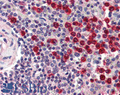 Anti-MMP9 / Gelatinase B Antibody IHC-plus LS-B2572