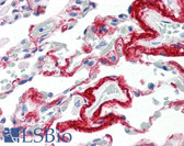 Anti-TIMP3 Antibody (aa170-188) IHC-plus LS-B2576