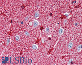 Anti-GLUL / Glutamine Synthetase Antibody (clone GS-6) IHC-plus LS-B2579