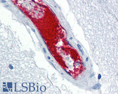 Anti-VWF / Von Willebrand Factor Antibody IHC-plus LS-B2590
