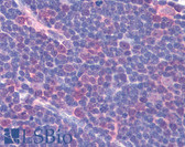 Anti-RAD51 / RECA Antibody IHC-plus LS-B2597