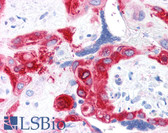 Anti-TGM2 / Transglutaminase 2 Antibody (clone 2A1) IHC-plus LS-B2599