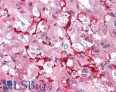 Anti-S100B / S100 Beta Antibody (C-Terminus, clone EP1576Y) IHC-plus LS-B2601