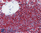 Anti-CD20 Antibody (C-Terminus) IHC-plus LS-B2605