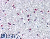 Anti-PITX3 Antibody (N-Terminus) IHC-plus LS-B2606
