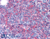 Anti-LCP1 / L-Plastin Antibody IHC-plus LS-B2608