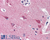 Anti-VGF Antibody (C-Terminus) IHC-plus LS-B2623