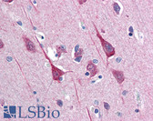 Anti-DISC1 Antibody (C-Terminus) IHC-plus LS-B2630