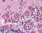 Anti-DISC1 Antibody (C-Terminus) IHC-plus LS-B2631