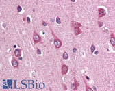 Anti-PAK3 Antibody (N-Terminus) IHC-plus LS-B2632
