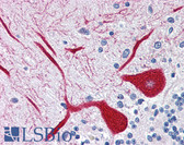 Anti-ITPR1 / IP3 Receptor Type 1 Antibody (aa1892-1911) IHC-plus LS-B2640