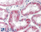 Anti-MMP2 Antibody (aa468-483) IHC-plus LS-B2641