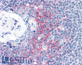Anti-ICAM-1 / CD54 Antibody IHC-plus LS-B2647