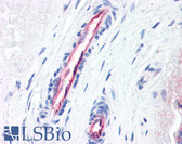 Anti-F2R / Thrombin Receptor / PAR1 Antibody (N-Terminus, clone ATAP2) IHC-plus LS-B2651