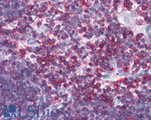 Anti-CD45 Antibody (C-Terminus) IHC-plus LS-B2660