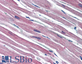 Anti-S100A1 / S100-A1 Antibody (C-Terminus) IHC-plus LS-B2667