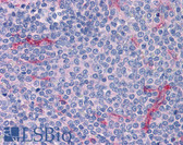 Anti-DEC-205 / CD205 / LY75 Antibody (N-Terminus) IHC-plus LS-B2668