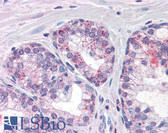 Anti-PDE11A Antibody (Internal) IHC-plus LS-B2676
