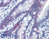 Anti-CASP6 / Caspase 6 Antibody (Cleavage Site) IHC-plus LS-B2679