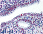 Anti-HSF1 Antibody IHC-plus LS-B2682