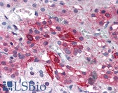 Anti-GRIK1 / GLUR5 Antibody (Internal) IHC-plus LS-B2692