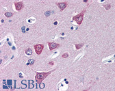 Anti-SOCS1 Antibody (N-Terminus) IHC-plus LS-B2698