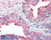 Anti-TNFRSF25 / DR3 Antibody (aa25-40) IHC-plus LS-B2705