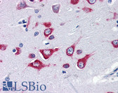 Anti-Kinesin 5A / KIF5A Antibody (Internal) IHC-plus LS-B2714