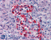 Anti-BID Antibody IHC-plus LS-B2716