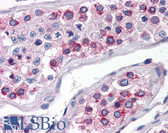 Anti-ATG16L1 / ATG16L Antibody (N-Terminus) IHC-plus LS-B2723