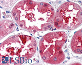 Anti-TEM7 Antibody (Internal) IHC-plus LS-B2727