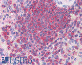 Anti-ARPC2 / p34-Arc Antibody (C-Terminus) IHC-plus LS-B2742