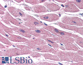 Anti-STRADB / ALS2CR2 Antibody (C-Terminus) IHC-plus LS-B2747