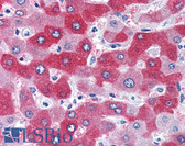 Anti-58K Golgi Protein / FTCD Antibody (Internal) IHC-plus LS-B2755