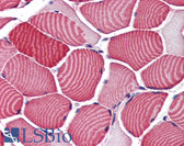 Anti-TBC1D4 / AS160 Antibody (Internal) IHC-plus LS-B2764