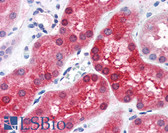 Anti-ABHD4 Antibody (aa177-187) IHC-plus LS-B2767
