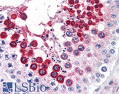 Anti-CXCR4 Antibody (aa13-38) IHC-plus LS-B2773