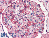 Anti-Nestin Antibody (aa1464-1614) IHC-plus LS-B2777