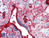 Anti-SLC2A1 / GLUT-1 Antibody (C-Terminus, clone SPM498) IHC-plus LS-B2780