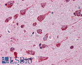 Anti-Phospho-Ser/Thr/Tyr Antibody (clone SPM101) IHC-plus LS-B2784