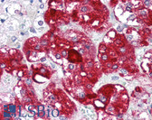 Anti-BIRC5 / Survivin Antibody (C-Terminus) IHC-plus LS-B2787
