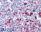 Anti-CD20 Antibody (clone MEM-269) IHC-plus LS-B2797