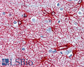 Anti-GFAP Antibody IHC-plus LS-B2801